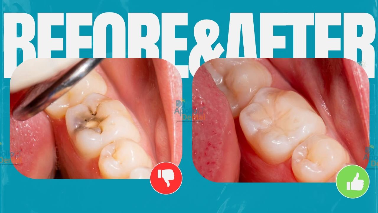Apollo dental clinics Hyderabad (10)