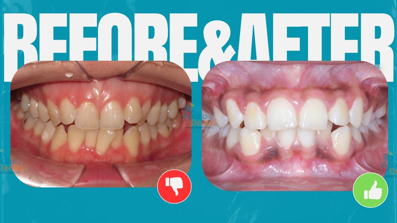 Apollo dental clinics Hyderabad (3)