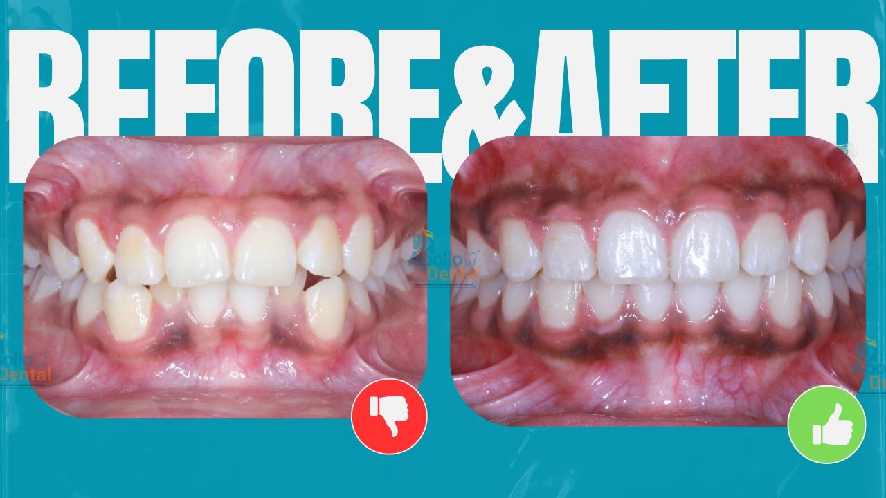 Apollo dental clinics Hyderabad (4)
