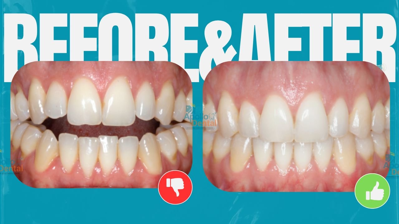 Apollo dental clinics Hyderabad (5)
