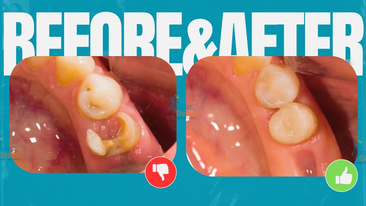 Apollo dental clinics Hyderabad (9)